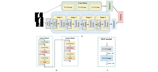 FuseLGNet: Fusion of Local and Global Information for Detection of Parkinson's Disease